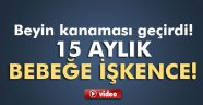 15 aylık bebekte darp şüphesi