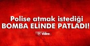 bomba elinde patladı