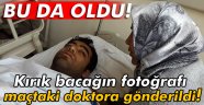 Kırık bacağın fotoğrafı doktora gönderildi