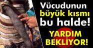 Suriyeli kızın dramı yürek burkuyor